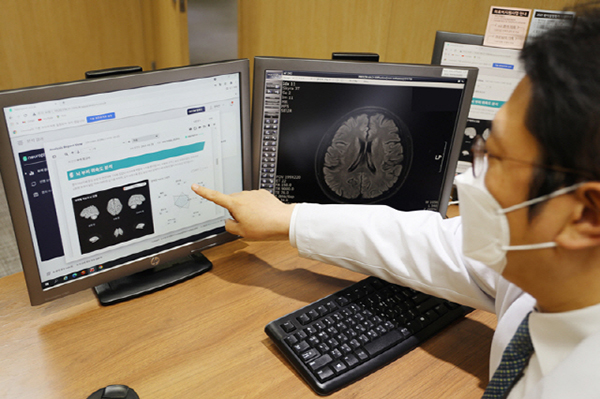 여의도성모병원, AI 기반 뇌 분석 프로그램 도입